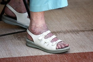 Choosing Shoes for Arthritic Feet