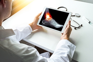 How Ankle Fractures Impact Seniors