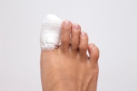 Traumatic Fractures vs. Stress Fractures in Toes
