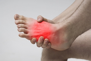 Causes of Stress Fractures